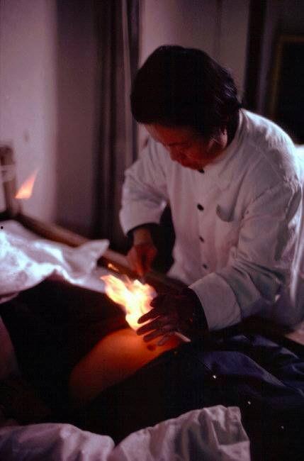 老中医做针灸视频爆料,传承千年养生智慧